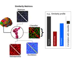 Measures of Neural Similarity